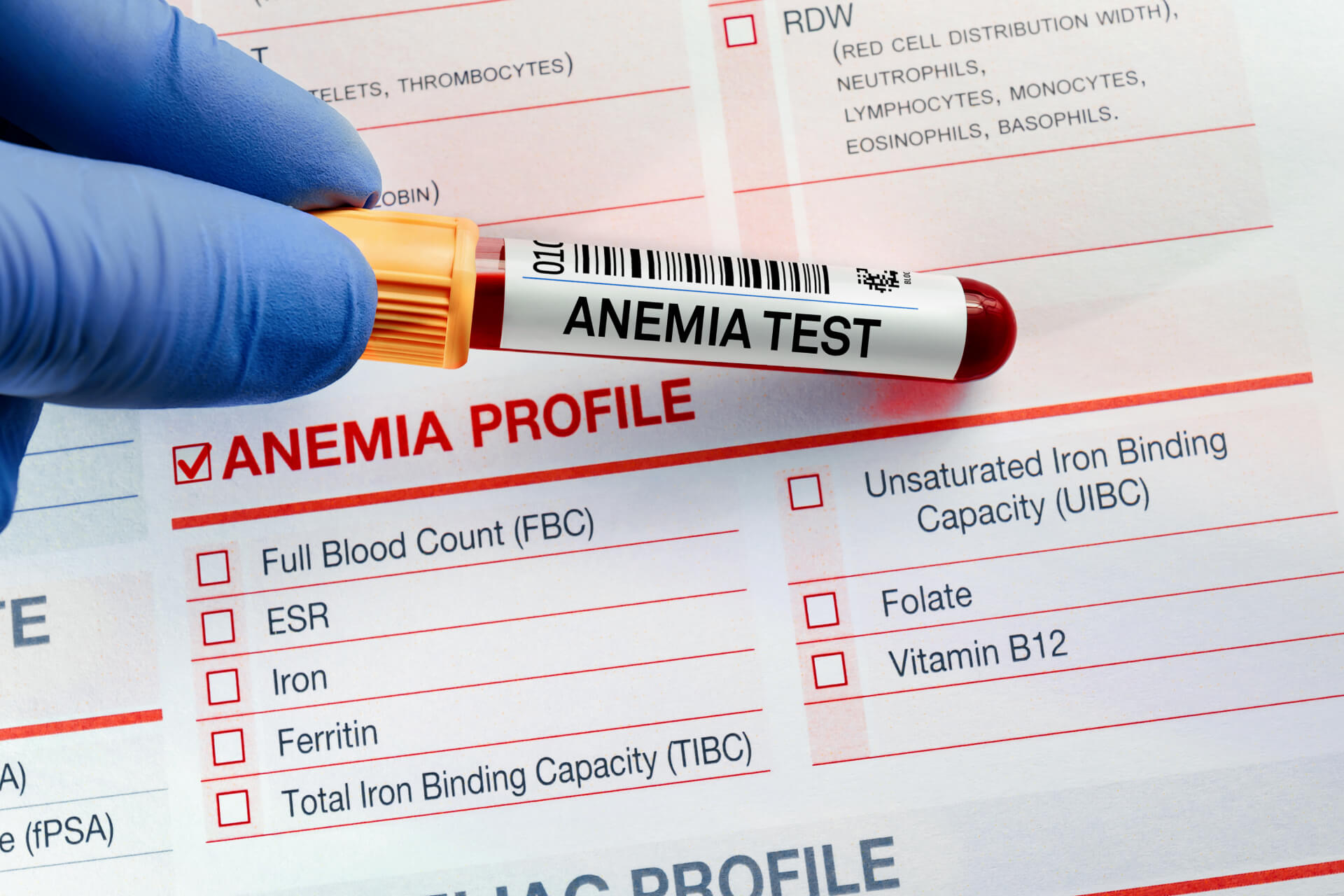 exame que detecta anemia